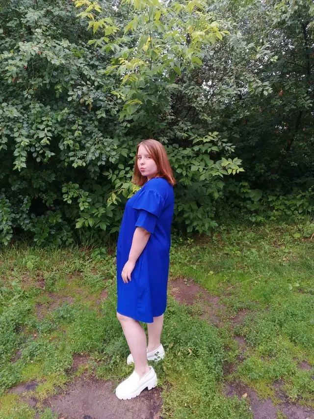 Избыточный вес (ИМТ>32), женщины