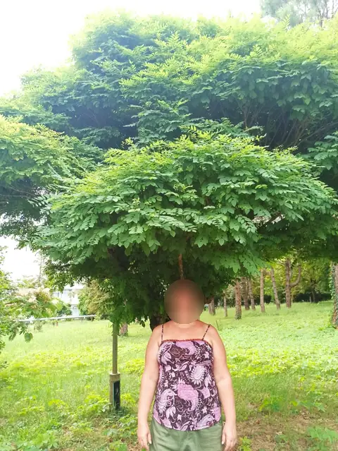 Избыточный вес (ИМТ>32), женщины