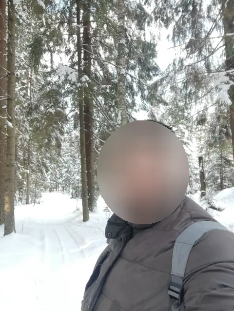 Избыточный вес (ИМТ>32), мужчины