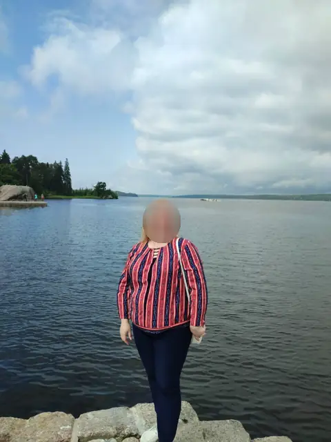 Избыточный вес (ИМТ>32), женщины
