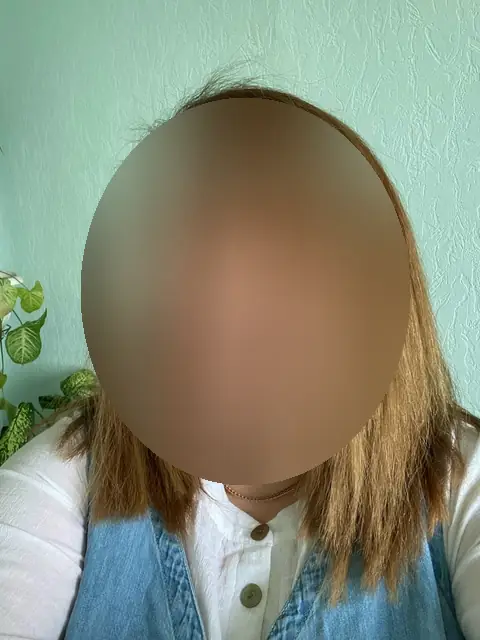 Избыточный вес (ИМТ>32), женщины