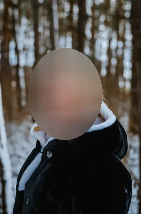 Избыточный вес (ИМТ>32), женщины