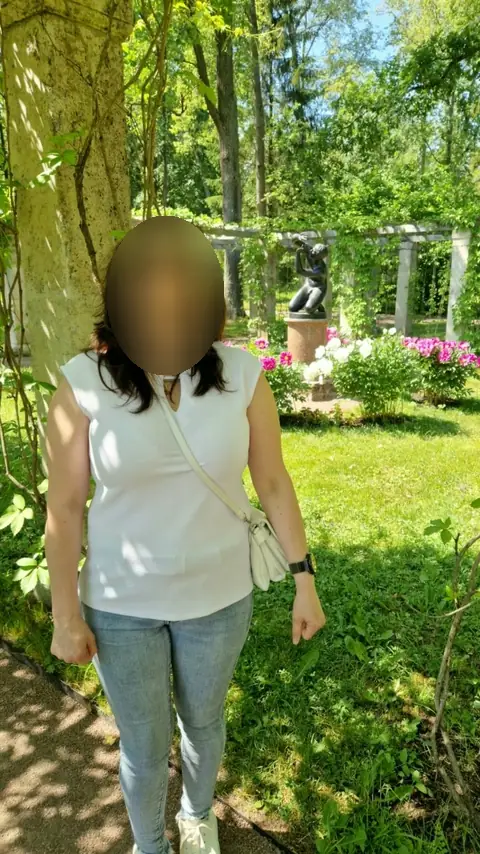 Избыточный вес (ИМТ>32), женщины