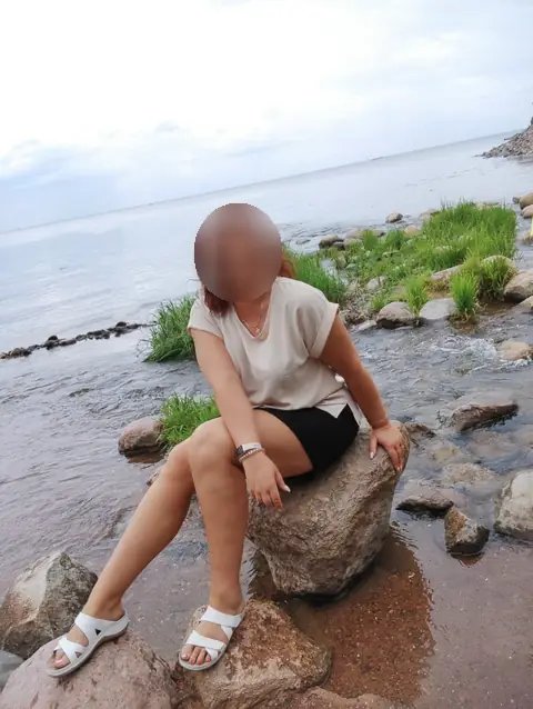 Избыточный вес (ИМТ>32), женщины